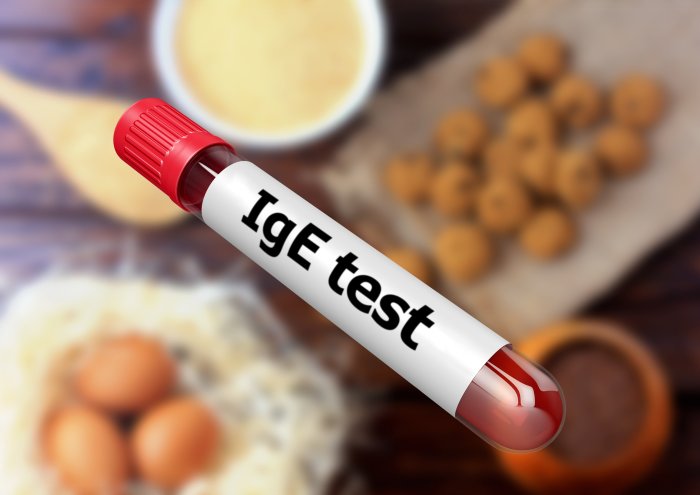 un éprouvette contenant du sang, portant la mention "IgE test" et, en arrière-plan, un certain nombre d'aliments